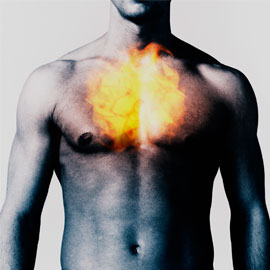 Exercise Induced Heartburn