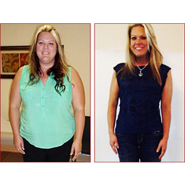 I Am So Proud Of Myself For Making The Decision - Deborah 1 Year After  Gastric Sleeve - BeLiteWeight